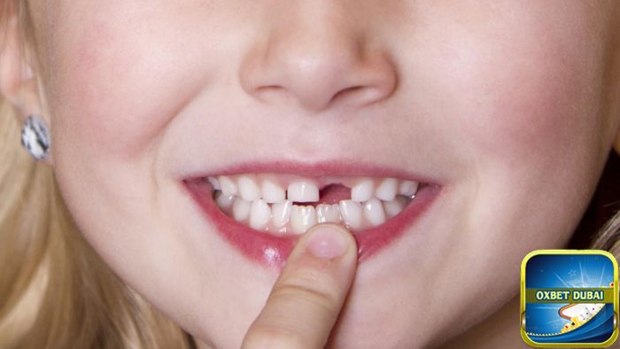 Chiêm bao thấy rụng răng cửa